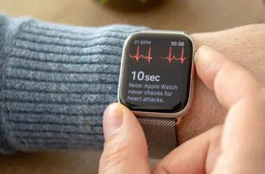 Ecg apple watch