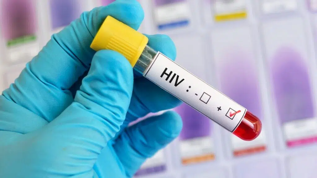 Especialista realizando teste de hiv