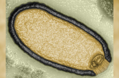 Amostra do vírus zumbi analisado por cientistas franceses em 2014, coletado do permafrost.