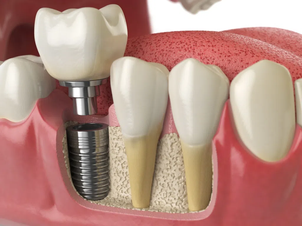 Droga que faz dentes crescerem naturalmente tem data para testes em humanos. Com desenvolvimento promissor desde julho de 2023, os primeiros testes da droga em animais foram bem-sucedidos. Testes em humanos se iniciam ainda este ano