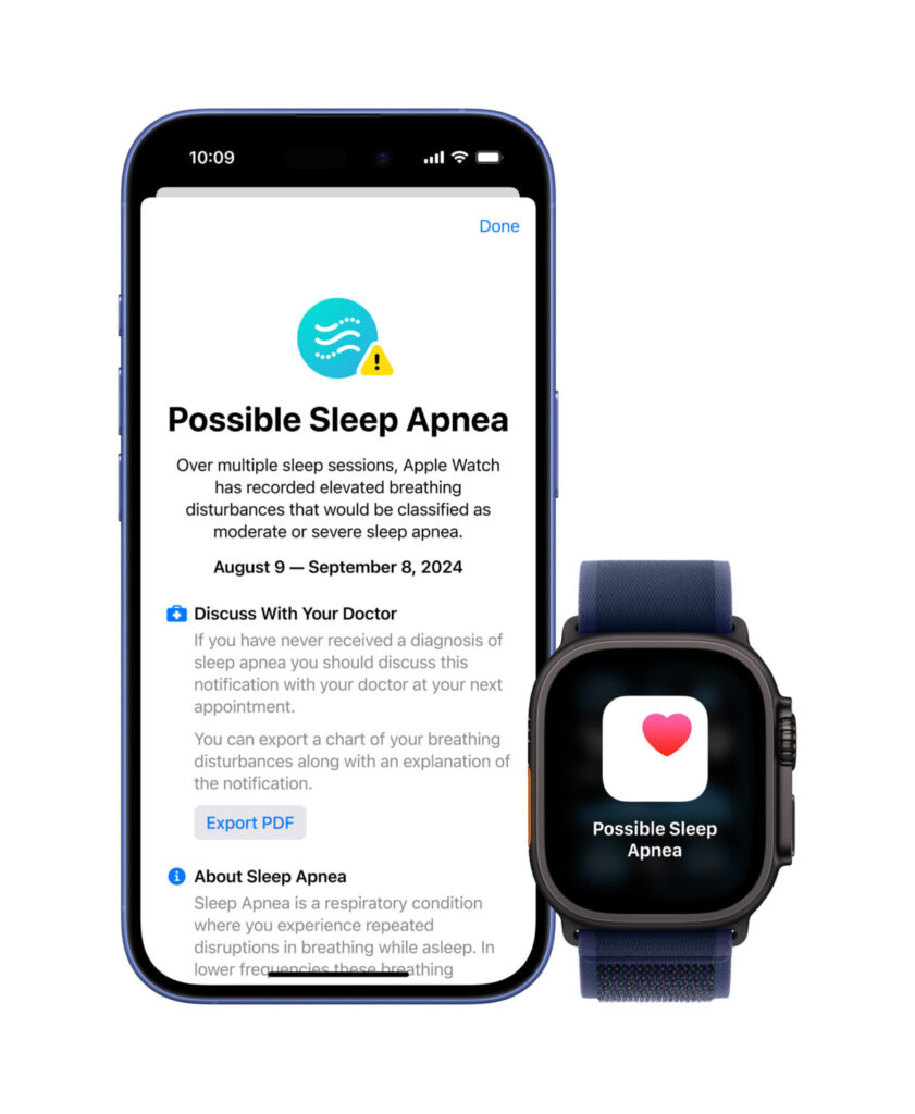 Apple watch series 10 e novo ultra 2 black são lançados a partir de r$ 5. 499 . Novos relógios inteligentes da marca são atualizados com telas maiores, novas cores e mais alertas de saúde. Confira