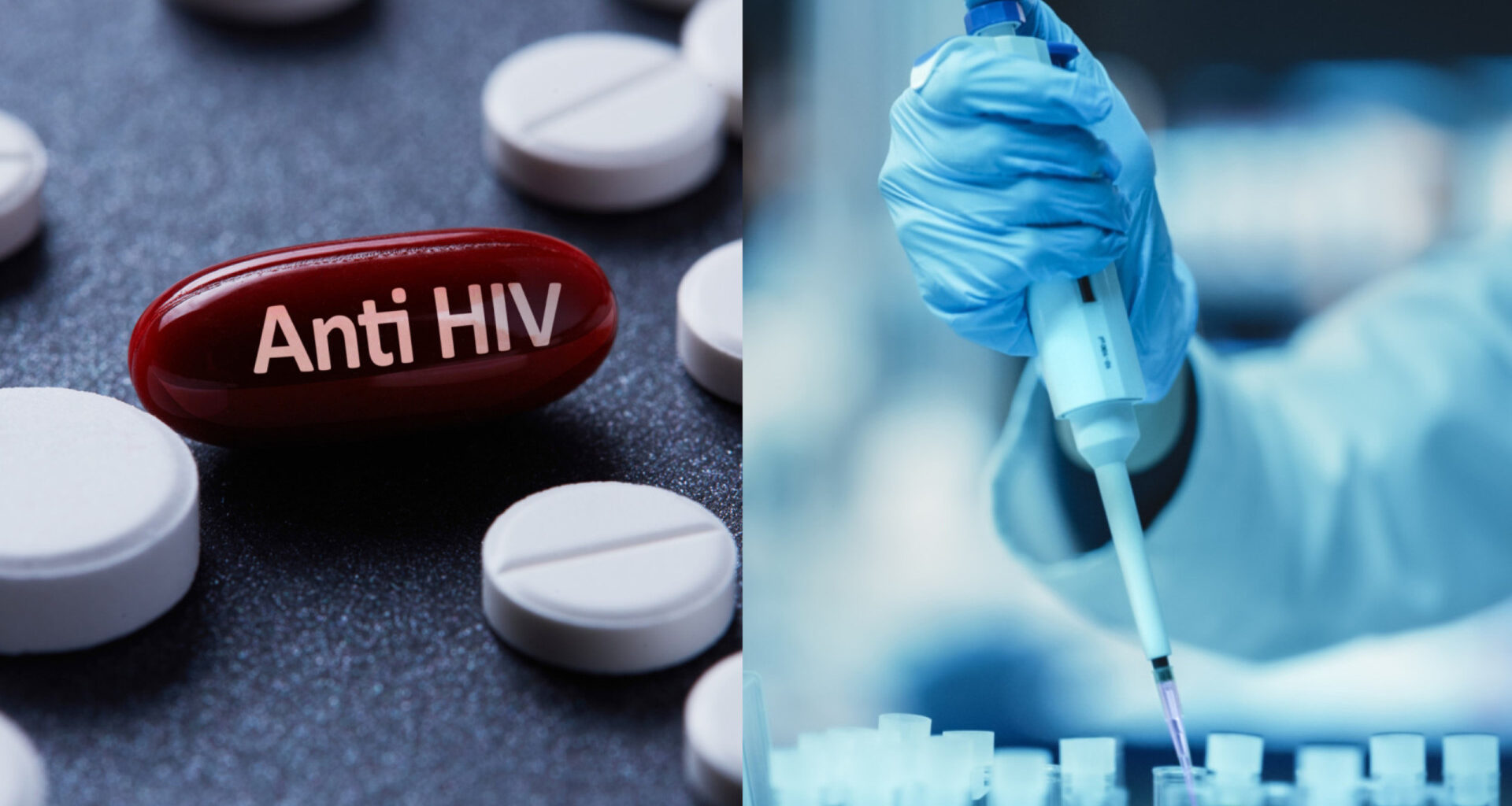 Conheça novos tratamentos e vacinas que podem revolucionar a luta contra o hiv. Foto: reprodução / shutterstock.