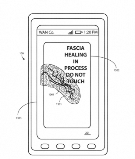 Motorola patenteou tela que pode consertar a si mesma com calor. A empresa já começou a desenvolver tecnologia que utiliza polímero com memória de forma para reparar danos no display.